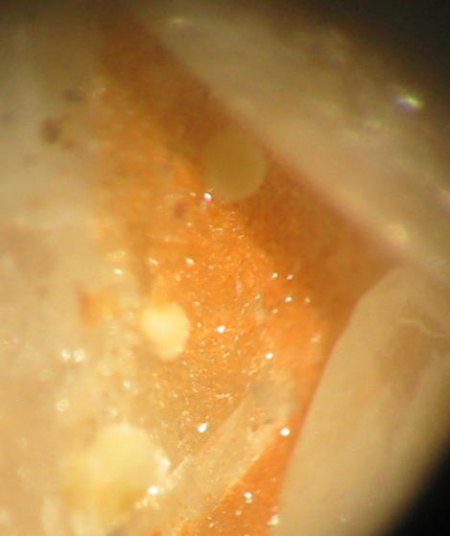 Phosphohedyphan (Neuenweg).jpg