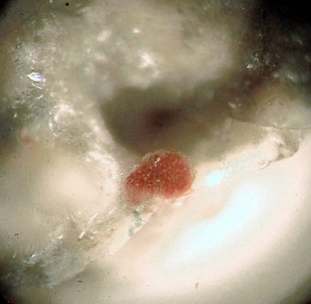 _Roedderit x rot_BB 4 mm_Bellerberg_Ettringen_Eifel_Peter_1.jpg