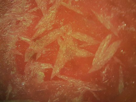 Unbekannte xx in Rhodochrosit