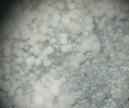 Hydromagnesit (Ronneburg).jpg